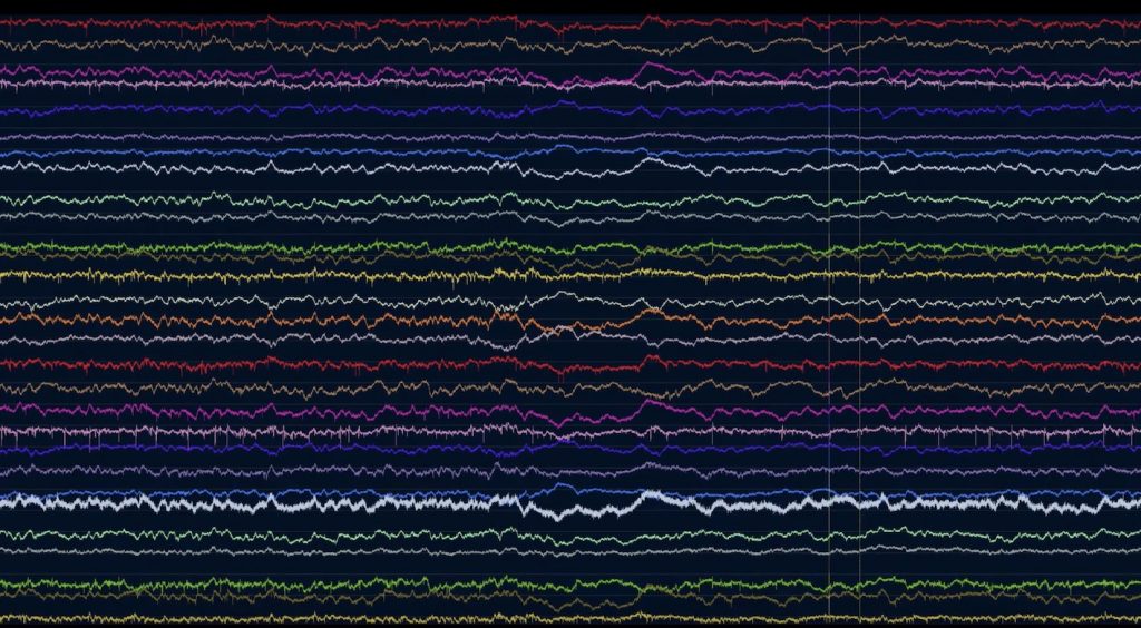 IMAGE: Action potentials map - Neuralink